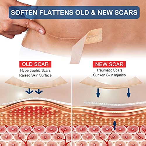 Silicone Scar Sheets Roll V9253