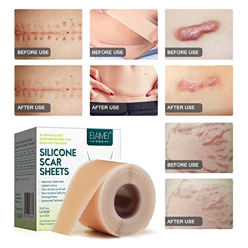 Silicone Scar Sheets Roll V9253